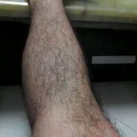 有腿毛的照片-女生有腿毛吗